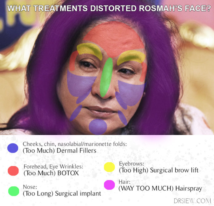 rosmah-treatment-dr-siew.jpg