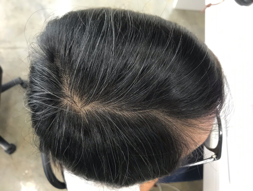 My hair started turning grey when I was 11. It was a traumatic childhood. -   - News from Singapore, Asia and around the world