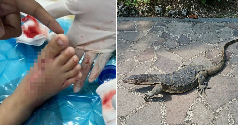 Boy 3 Gets 30 Stitches After Being Bitten By Monitor Lizard On Tioman Island Mothership Sg News From Singapore Asia And Around The World