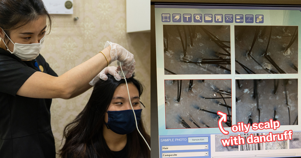 I went for a hair treatment to get rid of dandruff on my scalp. Here's what  happened.  - News from Singapore, Asia and around the world