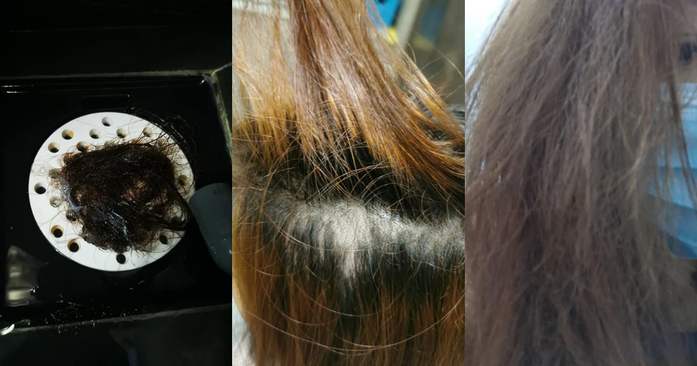 S'pore woman left with multiple bald spots after hair treatment, salon  allegedly sends lawyer's letter denying responsibility  -  News from Singapore, Asia and around the world