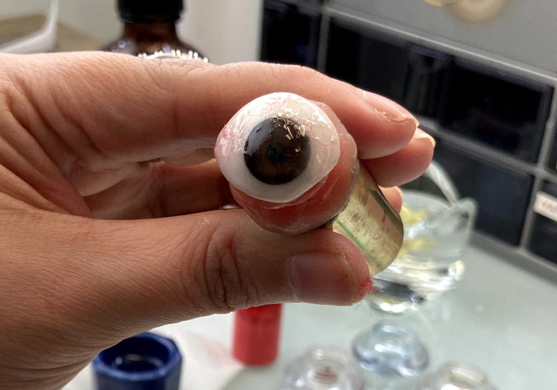 Prosthetic Eye Before And After