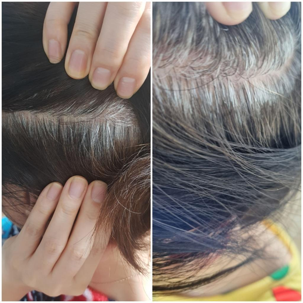I'm only 30 but why do I already have grey hair?  - News  from Singapore, Asia and around the world