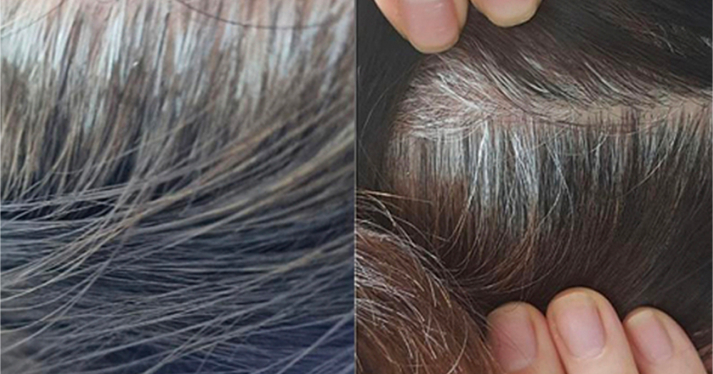 I'm only 30 but why do I already have grey hair?  - News  from Singapore, Asia and around the world
