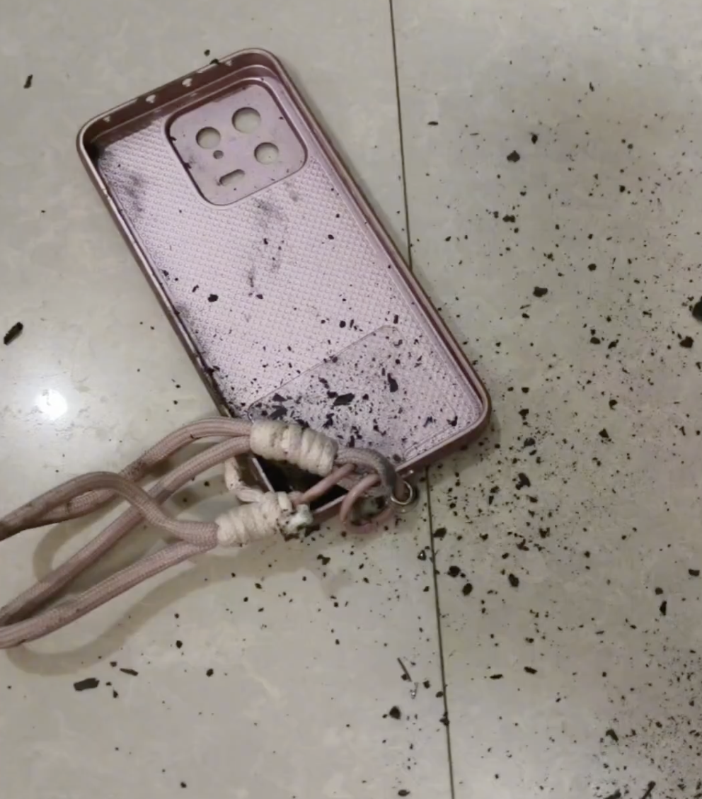 xiaomi phone explode china boy burnt