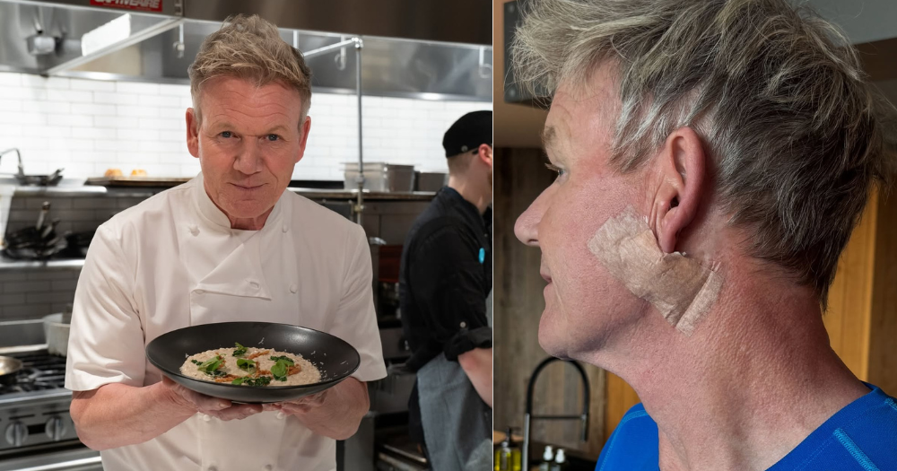 Gordon Ramsay undergoes treatment for skin cancer, reminds others to ...