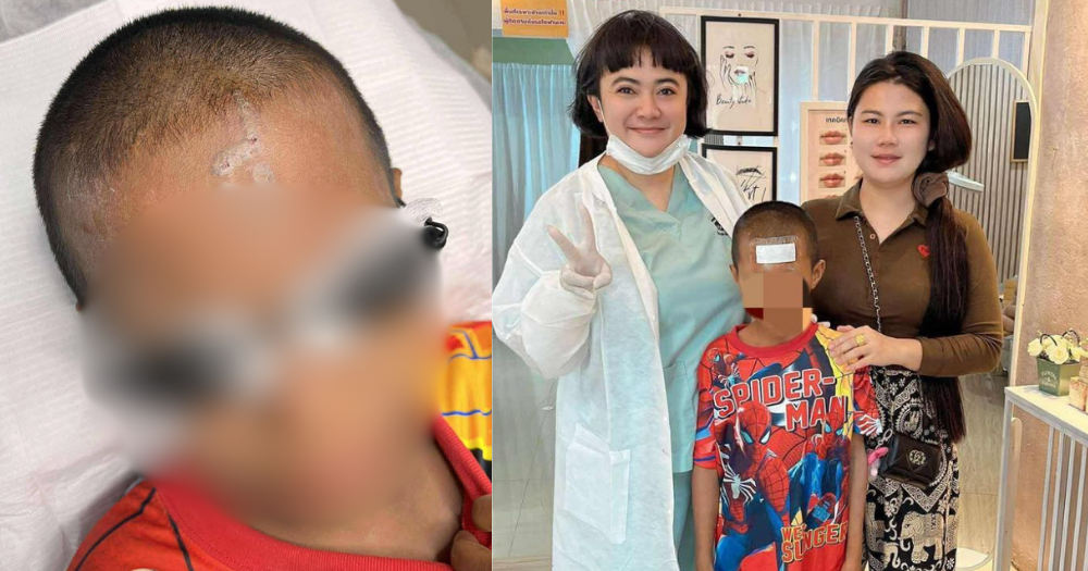 Bullies tattoo 'p*ssy' on forehead of Thai boy, 10, multiple laser sessions needed to remove it