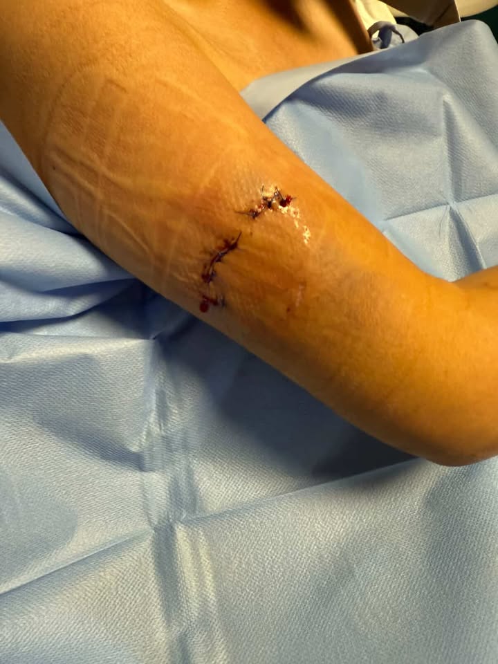 dog bite girl