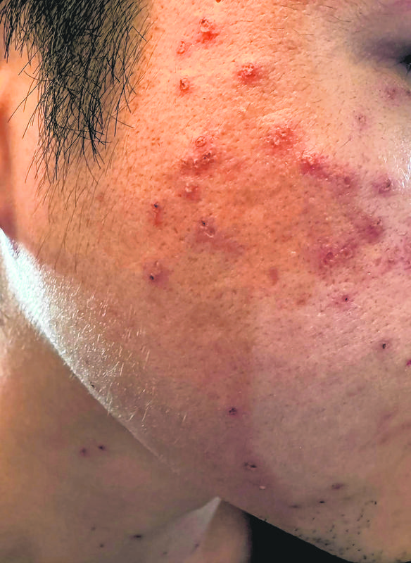couple pay 1200 treatment