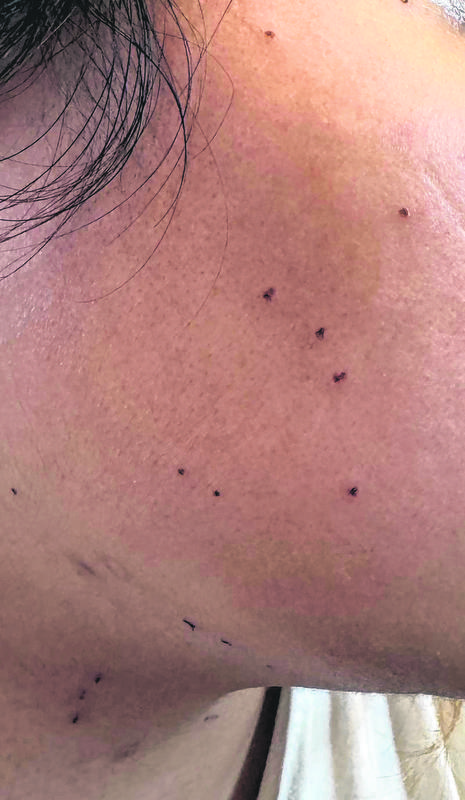 couple pay 1200 treatment
