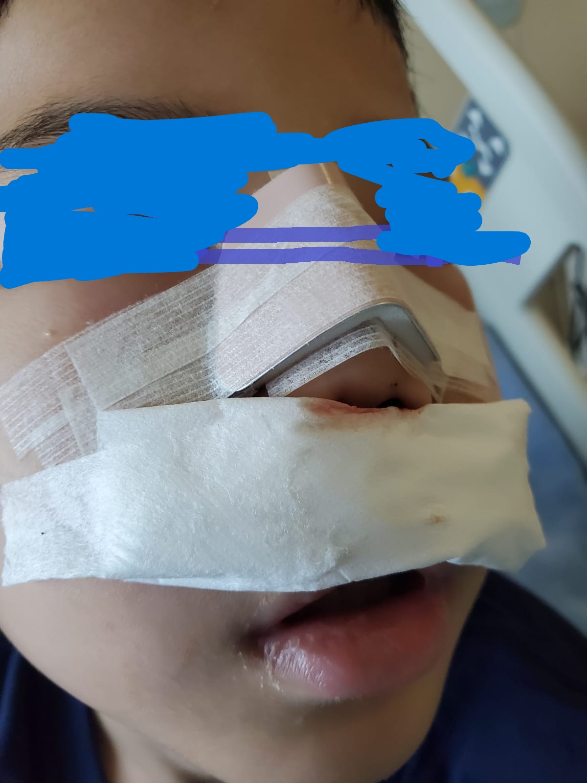 jewel walking net boy injured