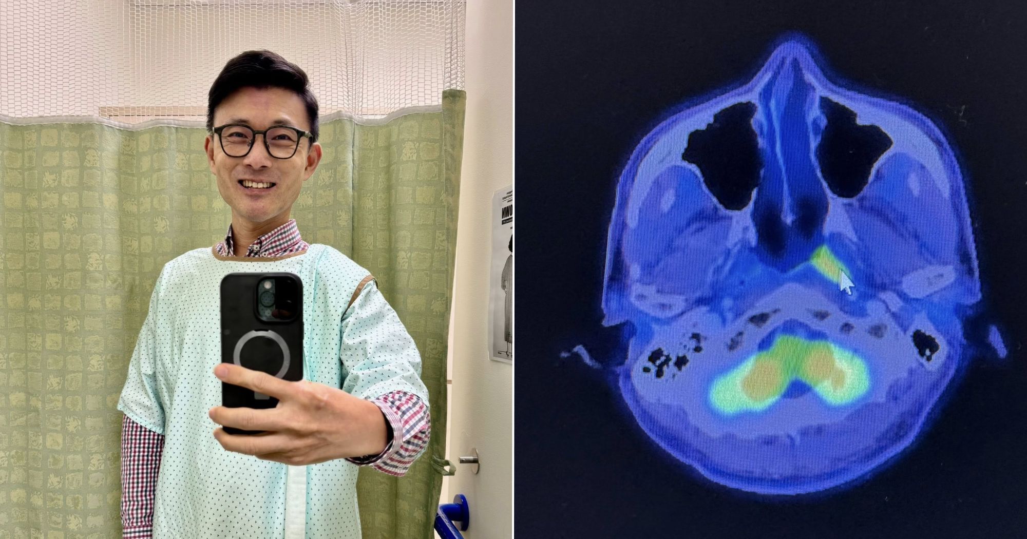 A deep sense of relief: Baey Yam Keng's MRI comes out clear after CT scans showed 'abnormality' on nose