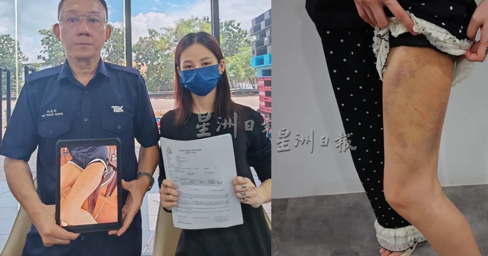 M'sian single mother, 28, says boyfriend of 6 months beat her after she kept in contact with ex-boyfriend