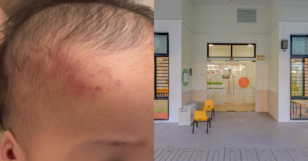 Infant gets head injury at Sengkang preschool, cause unable to be determined after almost a month